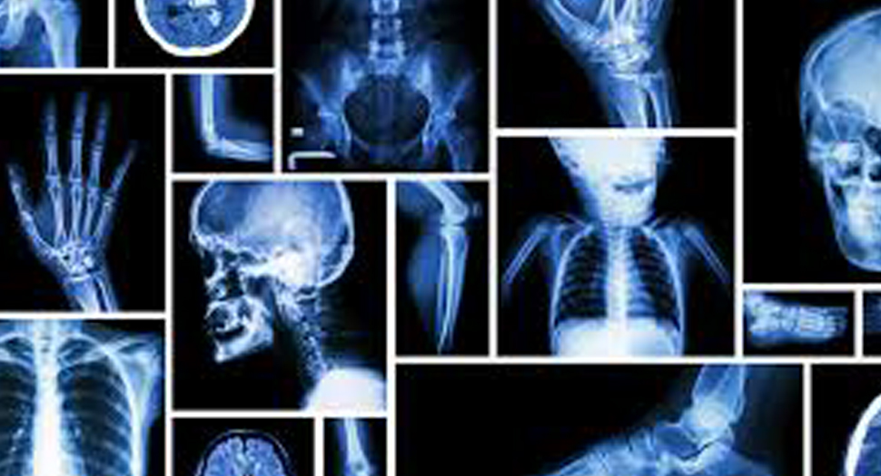Different Types Of X Rays Types Of X Rays That Work MJEAD Different Types Of X Rays Types Of X Rays That Work MJEAD