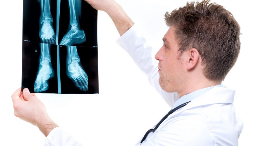 Doctor examining orthopedic radiology